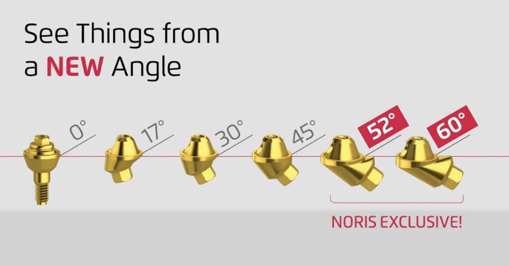 Noris Medical angled Multi-Unit abutments (45˚, 52˚ and 60˚) provide the angle correction needed.